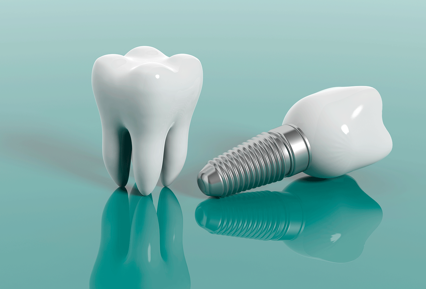 Implant-dentaire-Bourg-la-Reine-Soins-4